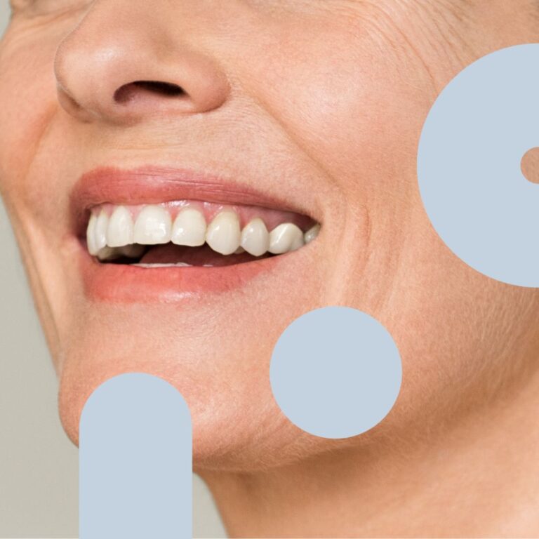 Restored smile with dental implants at Thames Dental & Skin clinic by Dr. Theodora Bravis, Thames Ditton.