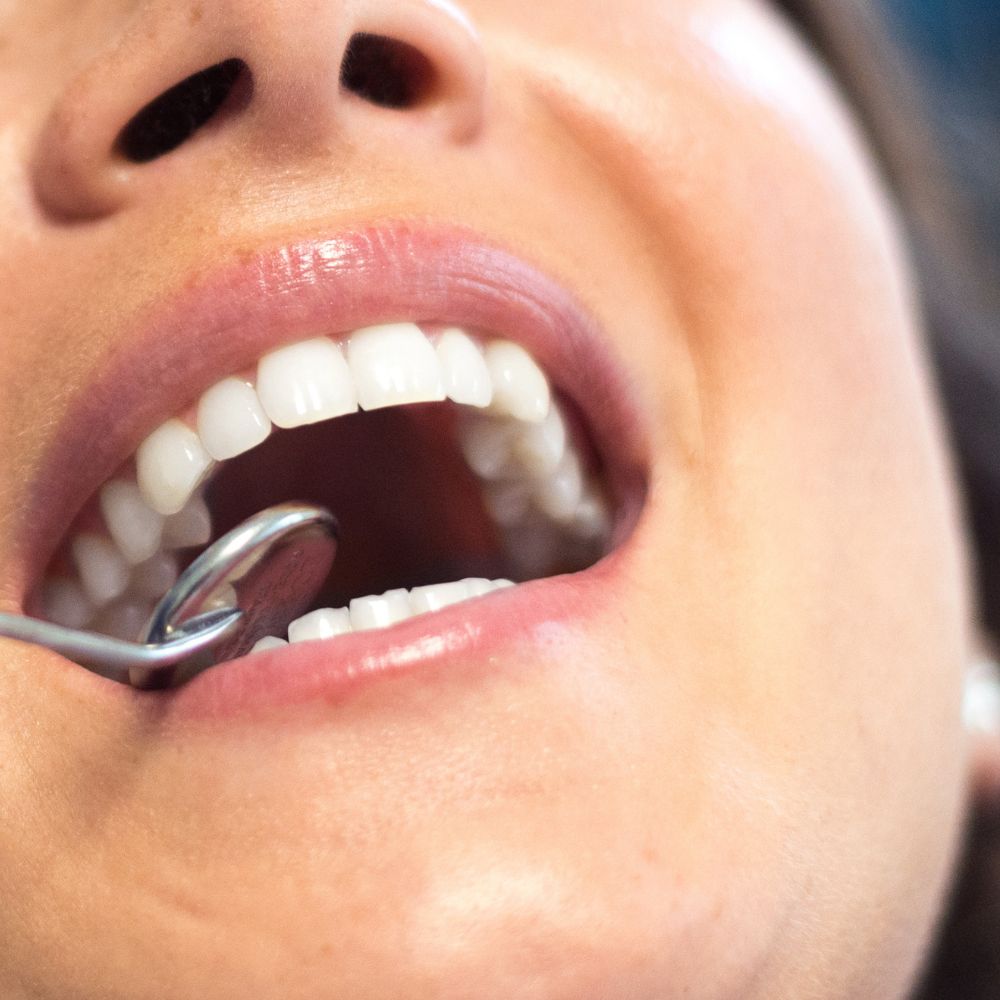 Closeup of Dr. Theodora Bravis examining patient's mouth with dental mirror at Thames Dental & Skin clinic in Thames Ditton, Surrey