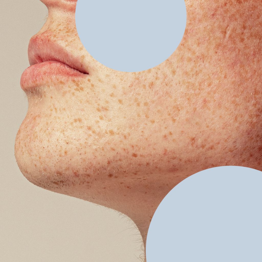 DNA nutrition consultation