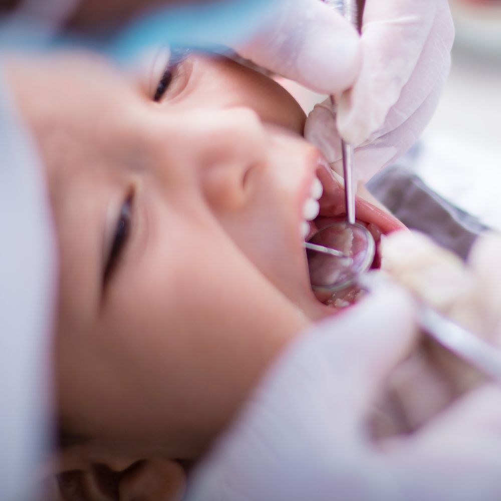 A little boy undergoes a gentle dental examination at Thames Dental & Skin Clinic in Thames Ditton, Surrey, by Dr Theodora Bravis, highlighting the clinic's focus on providing comfortable and comprehensive dental care for children.