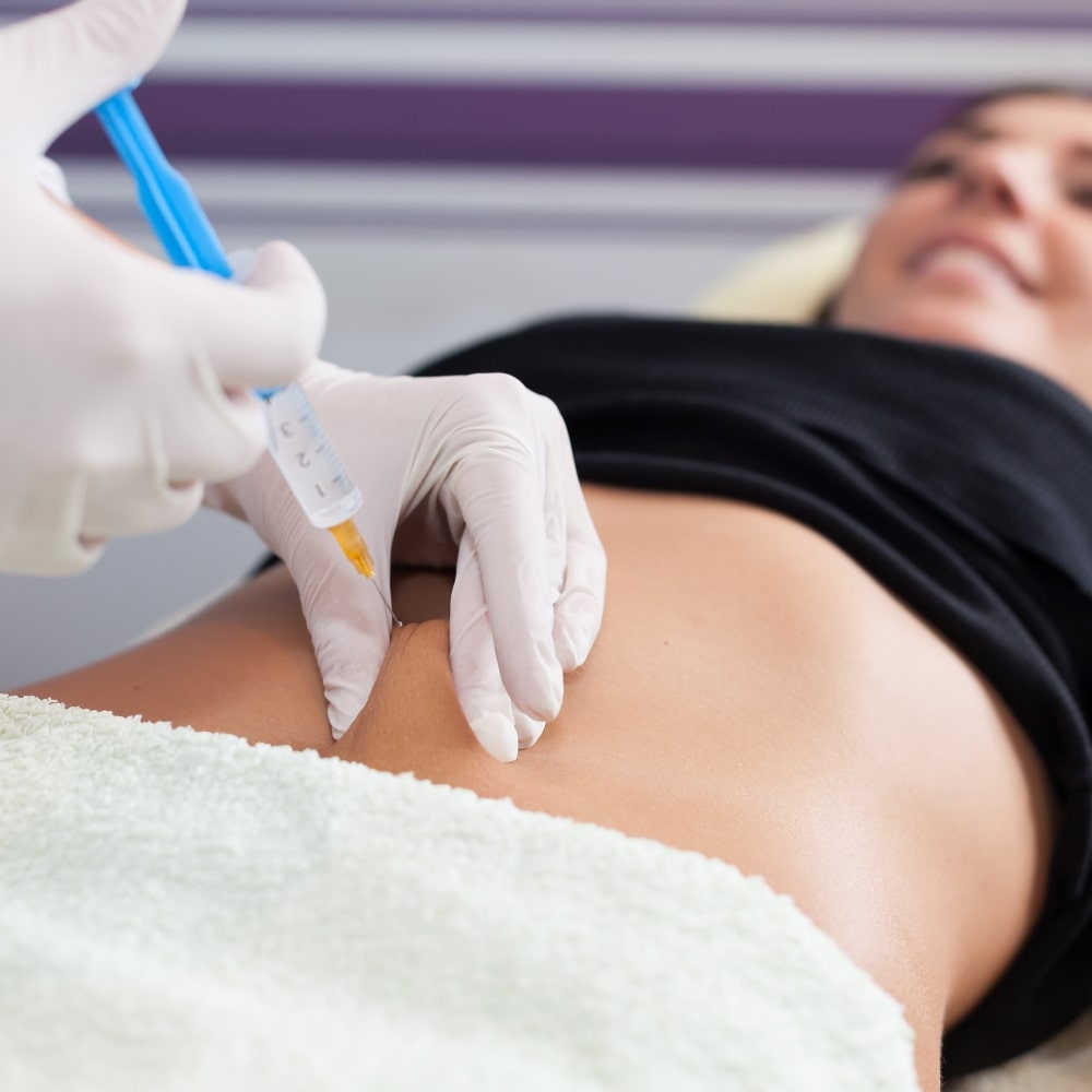 Profhilo body treatment applied to a woman's abdomen to improve skin firmness and reduce sagging.