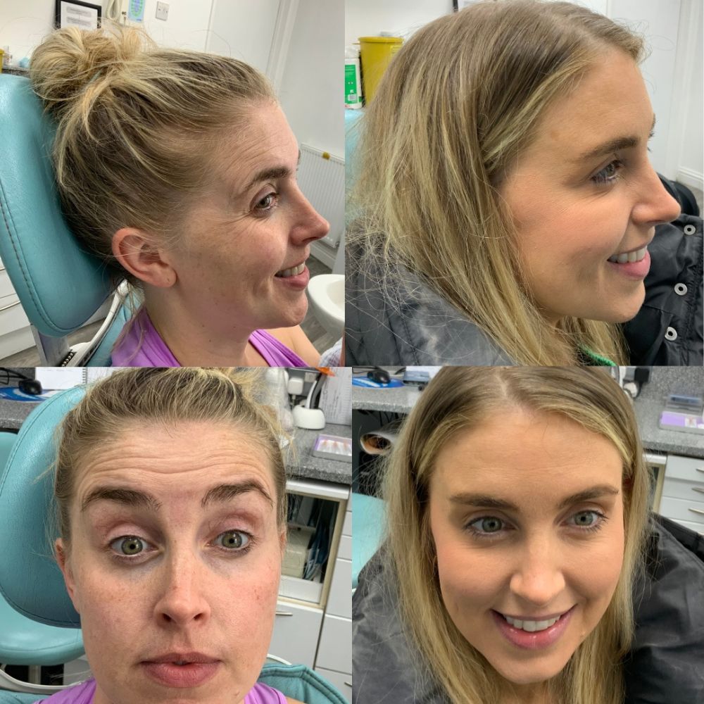 thames skin consultation