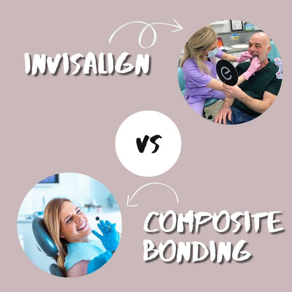 invisalign thames ditton