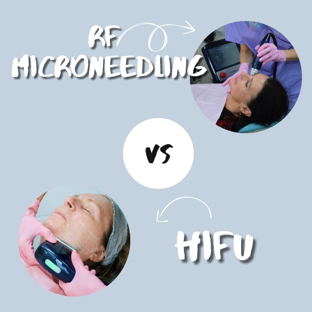 non-surgical facelift Thames Ditton